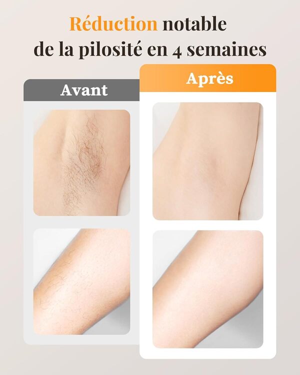 Haarlosy Épilateur Lumière Pulsée avec Fonction de Refroidissement Indolore, 999,900 Flashes IPL Epilation Laser[Définitive], 3 en 1 Épilation-[HR/SC/RA] pour Aisselles/Corps/Hommes/Femmes