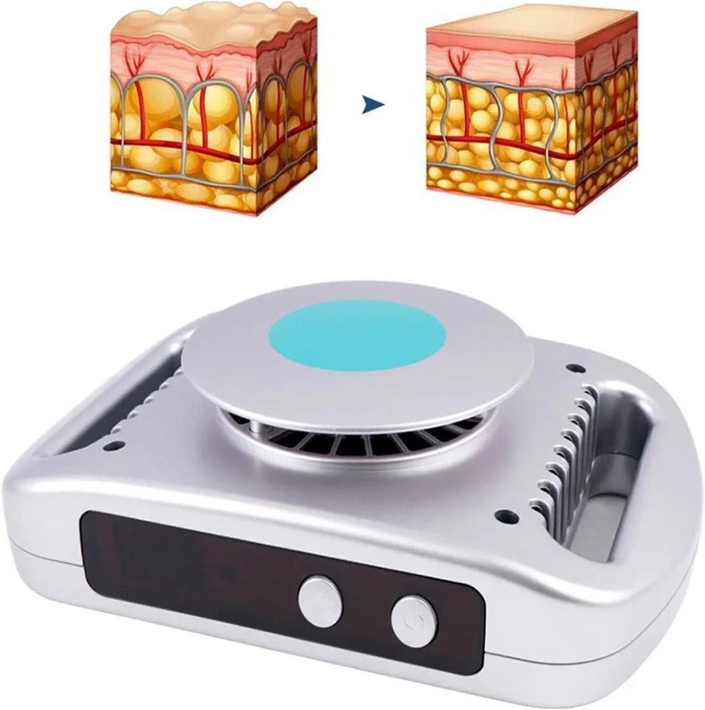 Test de la machine JIEXUHDE pour cryolipolyse portable