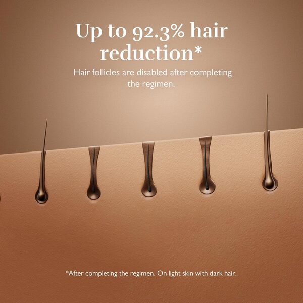 Silk’n Épilateur à Lumière Pulsée - Silk’n 7 - Appareil d’Épilation IPL avec Tête Rotative, 3 Accessoires et Rasoir - Visage, Corps, Bikini et Plus - Adapté à Toutes les Couleurs de Peau - Or Rose