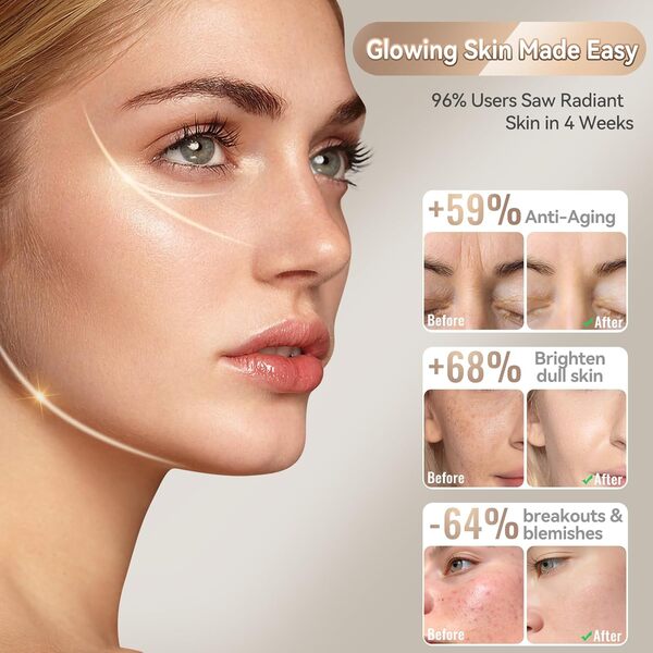 Masque LED Visage Luminothérapie: 400 Perles LED pour l’Anti-âge & la Régénération de la Peau avec 4 Couleurs pour Soin Professionnel à Domicile avec Minuterie & Télécommande & Protection des Yeux