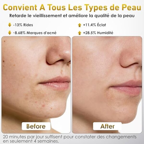 Découvrez le test complet du masque LED Ntyikul : sept couleurs et cinq niveaux pour une peau éclatante et rajeunie. Éclairage sur ses performances et bienfaits.