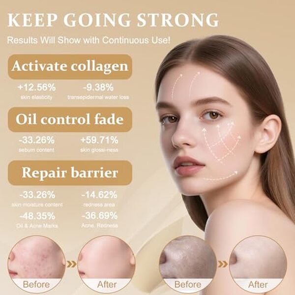 Découvrez notre test approfondi du masque visage LED Vhipu 4 couleurs anti-âge : efficacité des lumières LED pour une peau rajeunie, analyses et avis utilisateurs.